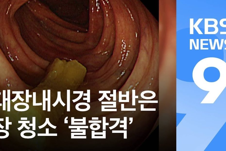 대장내시경 절반은 장 청소 ‘불합격’ / KBS뉴스(News)